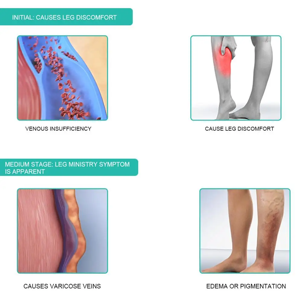 1Pair Medical Compression Sock - Compression Sock Medical บทวิจารณ์และราคา