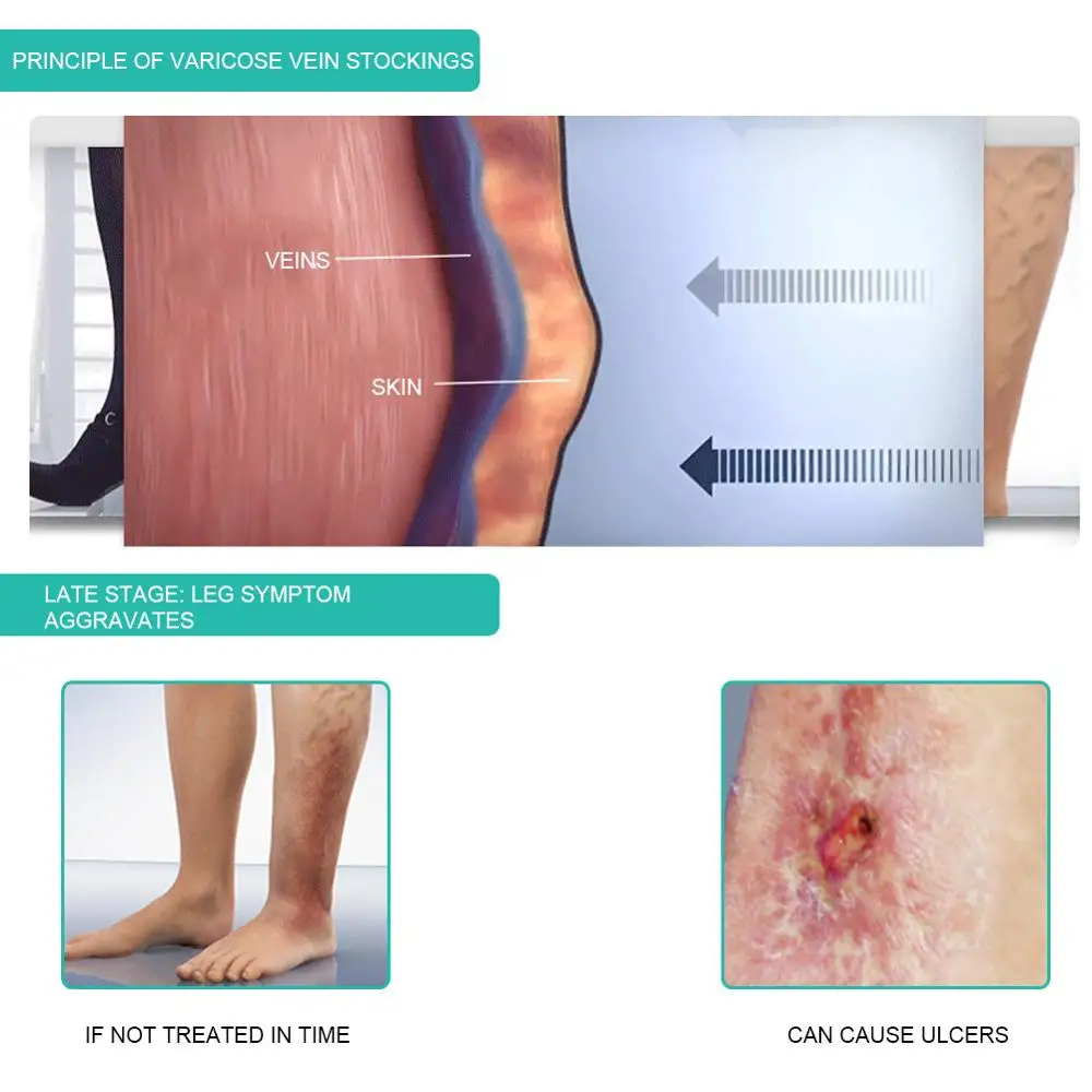 1Pair Medical Compression Sock - Compression Sock Medical บทวิจารณ์และราคา